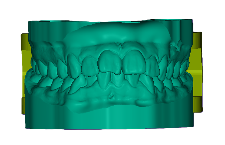 3D Articulated Study Model (42mm)