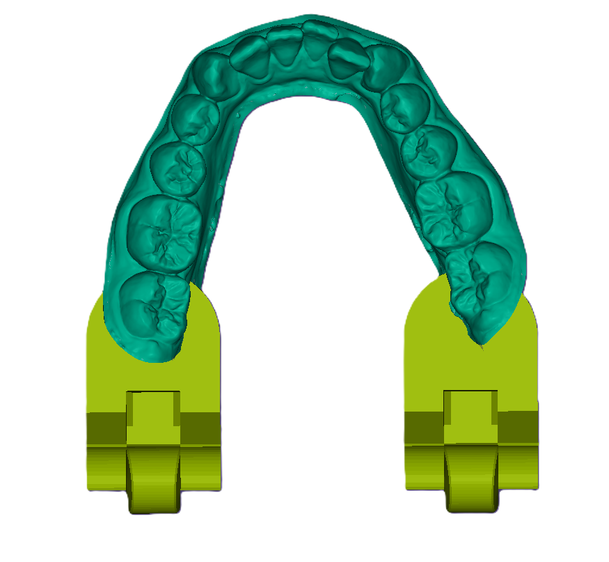 3D Articulated Study Model (42mm)