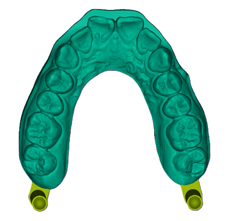 3D Study Model W/ Attachment (42mm)