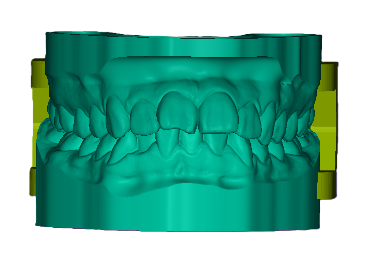 3D Articulated Study Model (42mm)