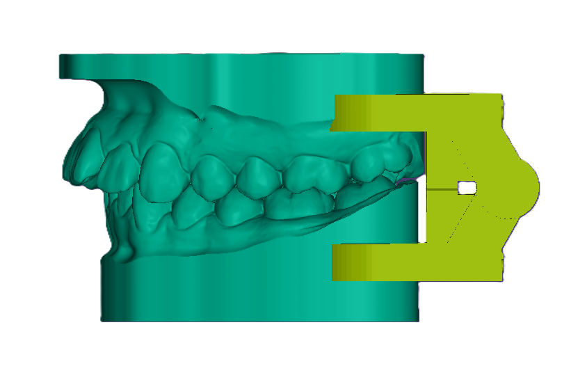 3D Articulated Study Model (42mm)