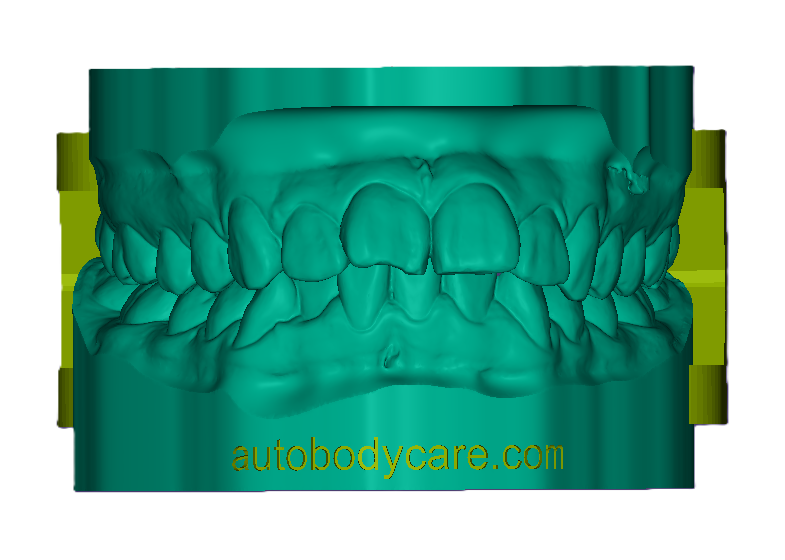 3D Articulated Study Model (42mm)