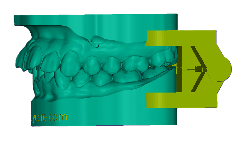 3D Articulated Study Model (42mm)