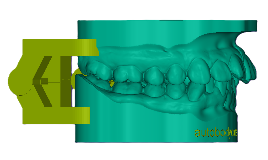 3D Articulated Study Model (42mm)
