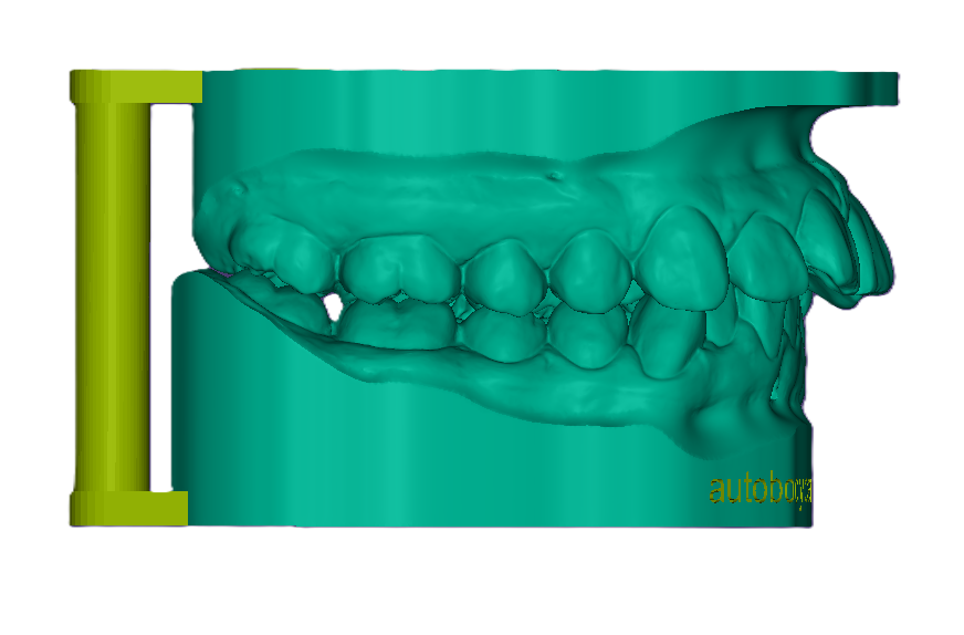 3D Study Model W/ Attachment (42mm)