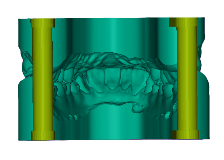 3D Study Model W/ Attachment (42mm)