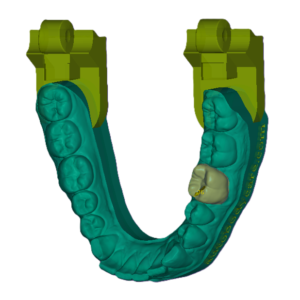 3D Dental Crown