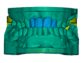 3D Dental Bridge and Mockup Model